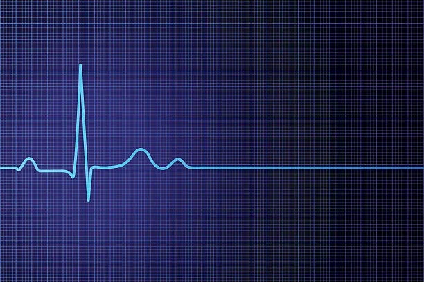 Blue and white EKG spike. 