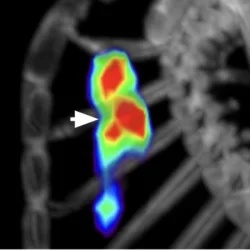 In Vivo Molecular Imaging of Cardiovascular Calcification