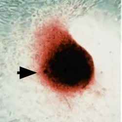 Detailed view of spontaneously calcifying vascular cells highlighted in red.